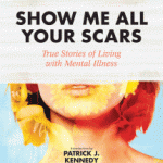 ShowMeAllYourScars_Cover_F